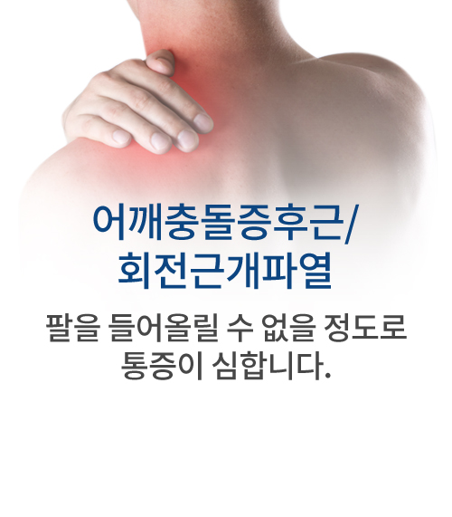 어깨충돌증후근/회전근개파열 팔을 들어올릴 수 없을 정도로 통증이 심합니다.