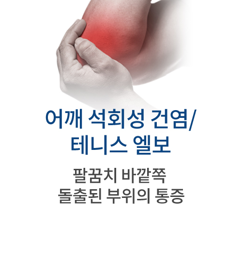 어깨 석회성 건염/테니스 엘보 팔꿈치 바깥쪽 돌출된 부위의 통증